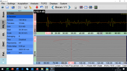 Logiciel d’acquisitions et d’analyses Ultrasonores EUROSCAN V 